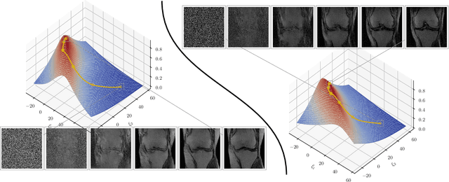 Figure 3 for Stable deep MRI reconstruction using Generative Priors