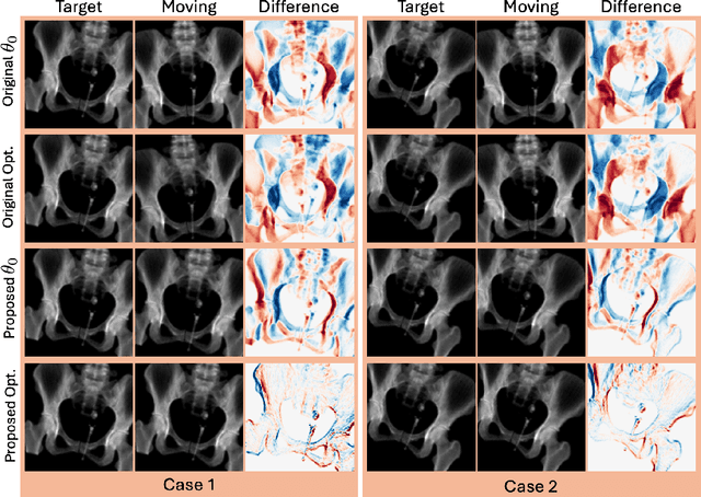 Figure 4 for Better Pose Initialization for Fast and Robust 2D/3D Pelvis Registration