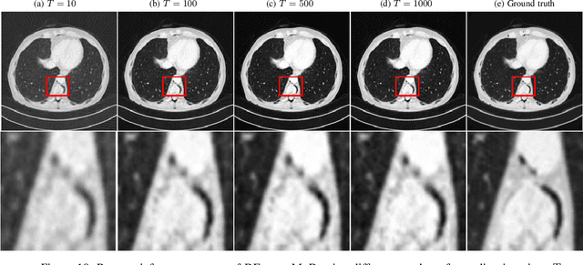 Figure 2 for Direct Dual-Energy CT Material Decomposition using Model-based Denoising Diffusion Model