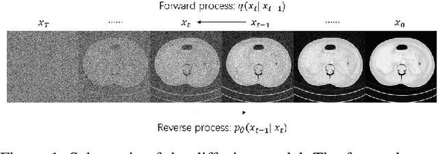 Figure 1 for Direct Dual-Energy CT Material Decomposition using Model-based Denoising Diffusion Model