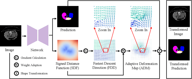 Figure 2 for Shape Transformation Driven by Active Contour for Class-Imbalanced Semi-Supervised Medical Image Segmentation