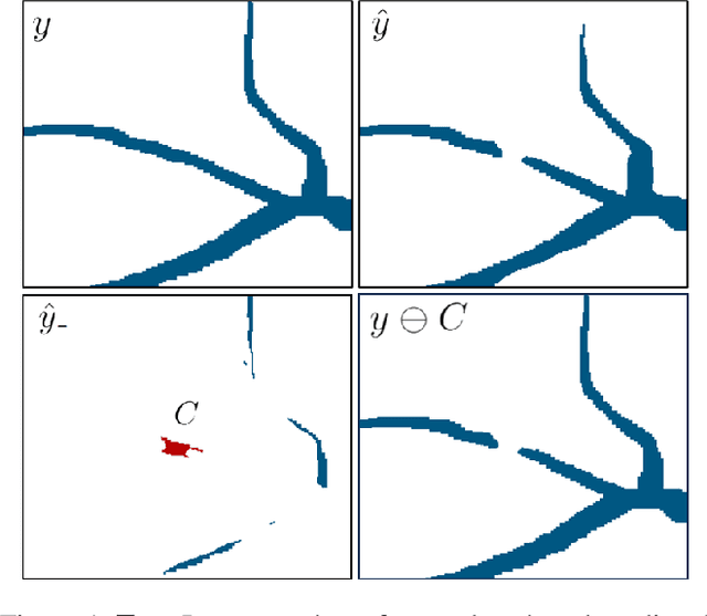 Figure 1 for Efficient Connectivity-Preserving Instance Segmentation with Supervoxel-Based Loss Function