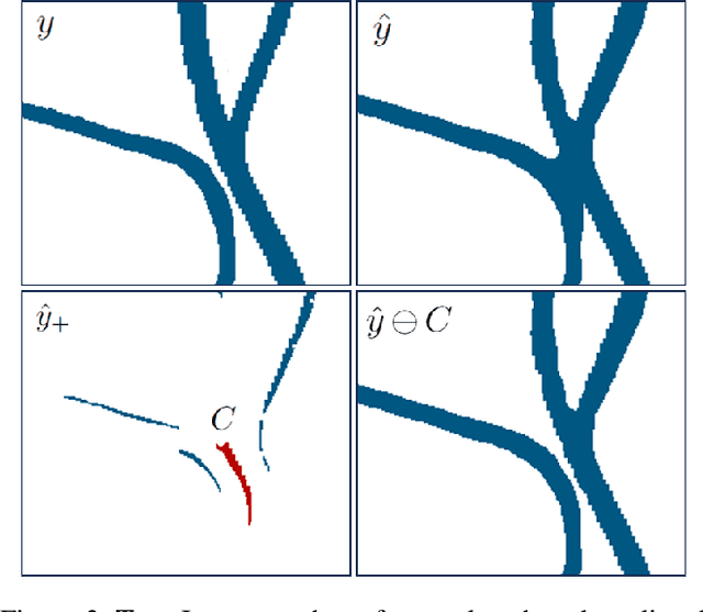 Figure 3 for Efficient Connectivity-Preserving Instance Segmentation with Supervoxel-Based Loss Function