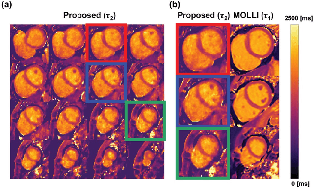 Figure 4 for Free-breathing 3D cardiac extracellular volume (ECV) mapping using a linear tangent space alignment (LTSA) model