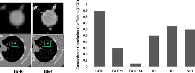 Figure 1 for Latent Diffusion Model for Medical Image Standardization and Enhancement