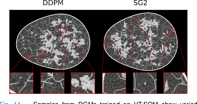 Figure 3 for Assessing the capacity of a denoising diffusion probabilistic model to reproduce spatial context