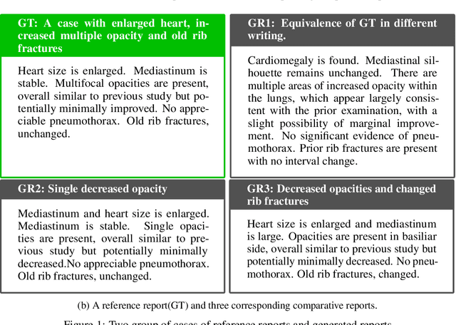 Figure 2 for LLM-RadJudge: Achieving Radiologist-Level Evaluation for X-Ray Report Generation