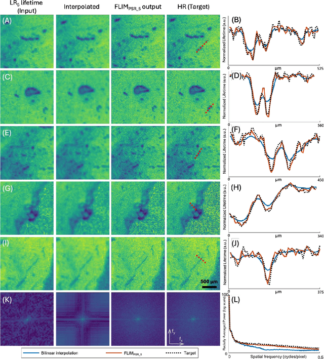 Figure 2 for Pixel Super-Resolved Fluorescence Lifetime Imaging Using Deep Learning