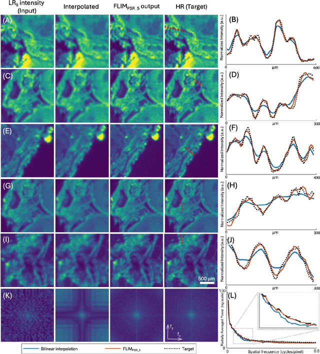 Figure 3 for Pixel Super-Resolved Fluorescence Lifetime Imaging Using Deep Learning