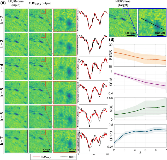 Figure 4 for Pixel Super-Resolved Fluorescence Lifetime Imaging Using Deep Learning