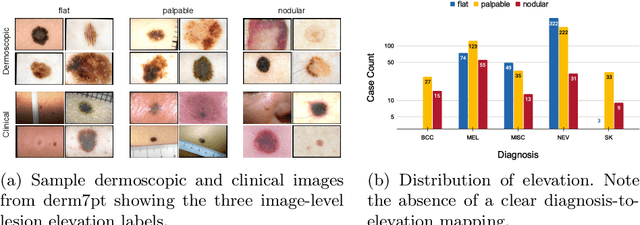 Figure 3 for Lesion Elevation Prediction from Skin Images Improves Diagnosis