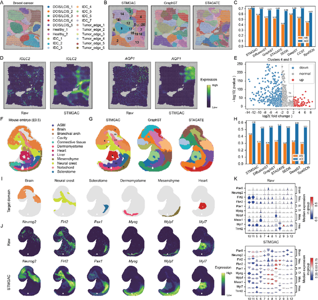 Figure 3 for Masked Graph Autoencoders with Contrastive Augmentation for Spatially Resolved Transcriptomics Data