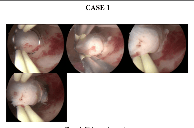 Figure 2 for Enhancing Medical Task Performance in GPT-4V: A Comprehensive Study on Prompt Engineering Strategies