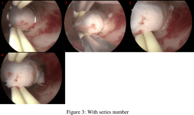 Figure 3 for Enhancing Medical Task Performance in GPT-4V: A Comprehensive Study on Prompt Engineering Strategies