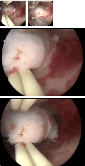 Figure 4 for Enhancing Medical Task Performance in GPT-4V: A Comprehensive Study on Prompt Engineering Strategies