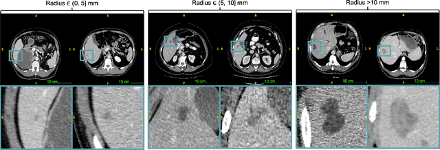 Figure 1 for Label-Free Liver Tumor Segmentation