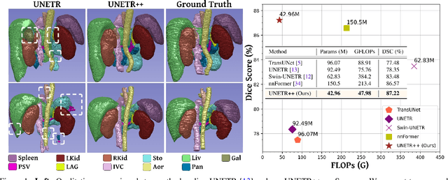 Figure 1 for UNETR++: Delving into Efficient and Accurate 3D Medical Image Segmentation