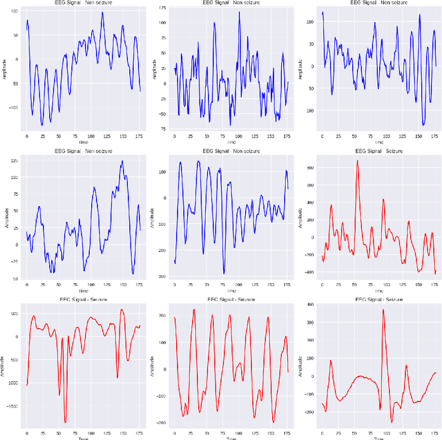 Figure 1 for Hybrid Deep Learning Model for epileptic seizure classification by using 1D-CNN with multi-head attention mechanism