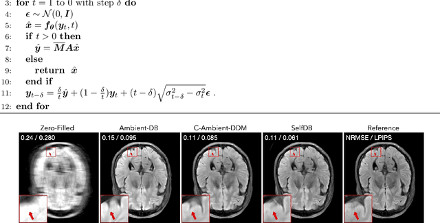 Figure 1 for A Self-supervised Diffusion Bridge for MRI Reconstruction