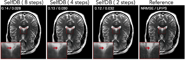 Figure 3 for A Self-supervised Diffusion Bridge for MRI Reconstruction