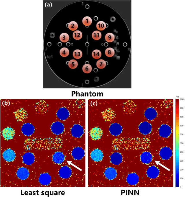 Figure 2 for Bloch Equation Enables Physics-informed Neural Network in Parametric Magnetic Resonance Imaging