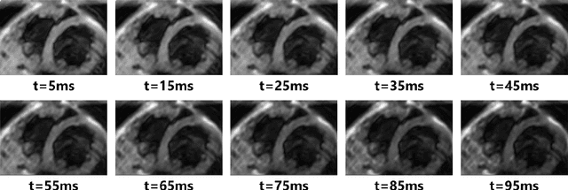 Figure 4 for Bloch Equation Enables Physics-informed Neural Network in Parametric Magnetic Resonance Imaging