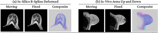 Figure 3 for Diffeomorphic Multi-Resolution Deep Learning Registration for Applications in Breast MRI