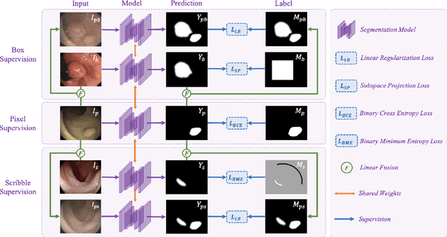 Figure 1 for MixPolyp: Integrating Mask, Box and Scribble Supervision for Enhanced Polyp Segmentation