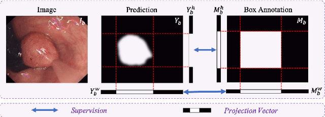 Figure 2 for MixPolyp: Integrating Mask, Box and Scribble Supervision for Enhanced Polyp Segmentation