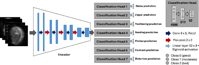 Figure 3 for Automated quality assessment using appearance-based simulations and hippocampus segmentation on low-field paediatric brain MR images