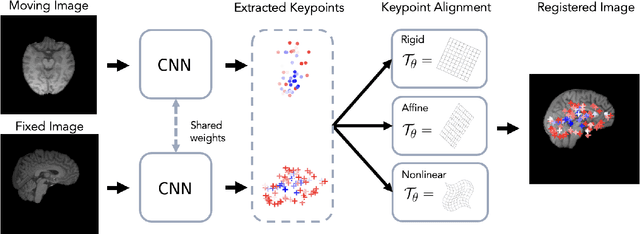 Figure 2 for BrainMorph: A Foundational Keypoint Model for Robust and Flexible Brain MRI Registration