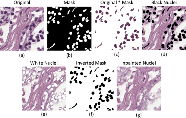 Figure 4 for Are nuclear masks all you need for improved out-of-domain generalisation? A closer look at cancer classification in histopathology