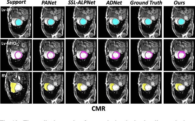 Figure 2 for Partition-A-Medical-Image: Extracting Multiple Representative Sub-regions for Few-shot Medical Image Segmentation