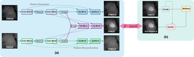 Figure 1 for Zero-Shot Denoising for Fluorescence Lifetime Imaging Microscopy with Intensity-Guided Learning