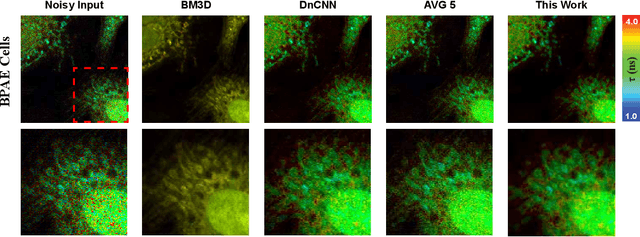 Figure 3 for Zero-Shot Denoising for Fluorescence Lifetime Imaging Microscopy with Intensity-Guided Learning