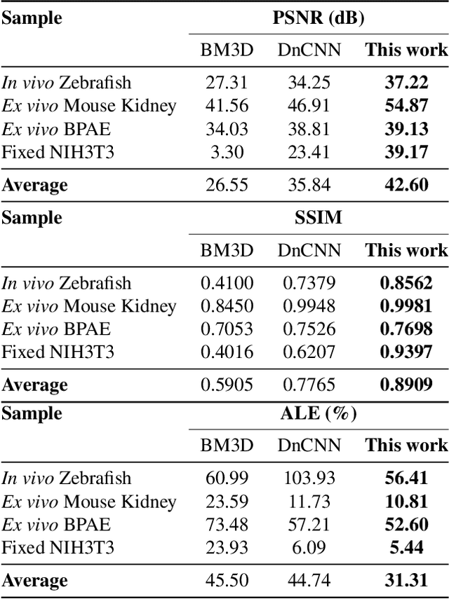 Figure 2 for Zero-Shot Denoising for Fluorescence Lifetime Imaging Microscopy with Intensity-Guided Learning