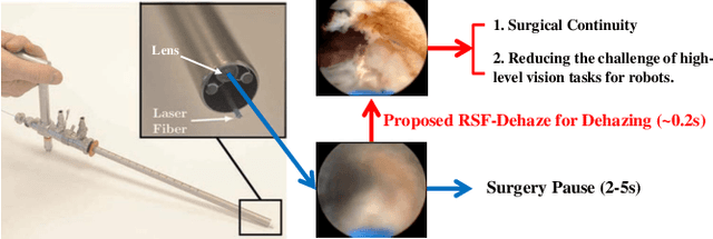 Figure 1 for Toward Zero-Shot Learning for Visual Dehazing of Urological Surgical Robots