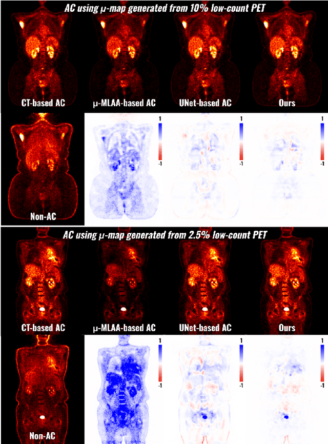 Figure 4 for POUR-Net: A Population-Prior-Aided Over-Under-Representation Network for Low-Count PET Attenuation Map Generation