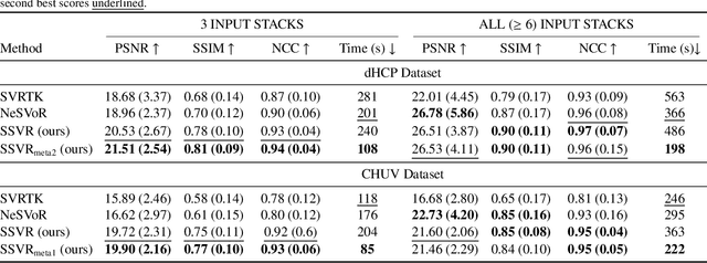 Figure 4 for Meta-learning Slice-to-Volume Reconstruction in Fetal Brain MRI using Implicit Neural Representations