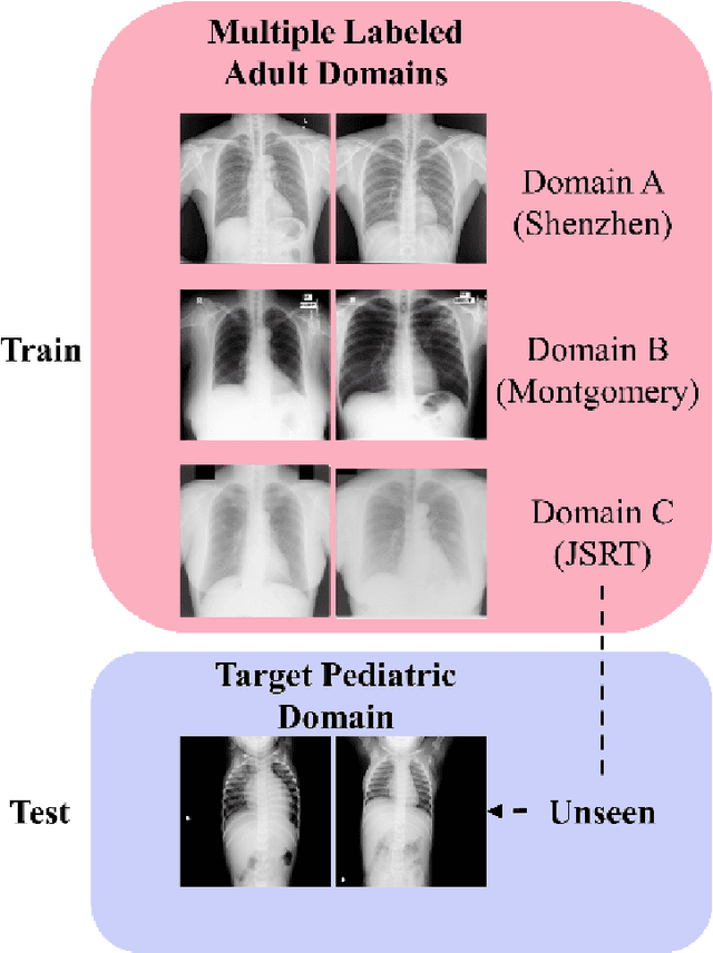 Figure 1 for Generalizability of Deep Adult Lung Segmentation Models to the Pediatric Population: A Retrospective Study