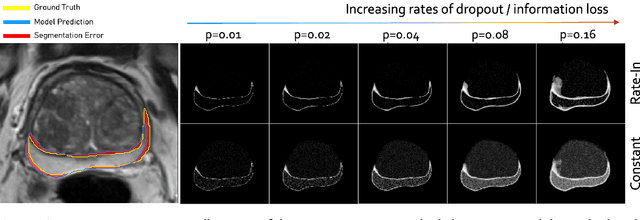 Figure 1 for Rate-In: Information-Driven Adaptive Dropout Rates for Improved Inference-Time Uncertainty Estimation