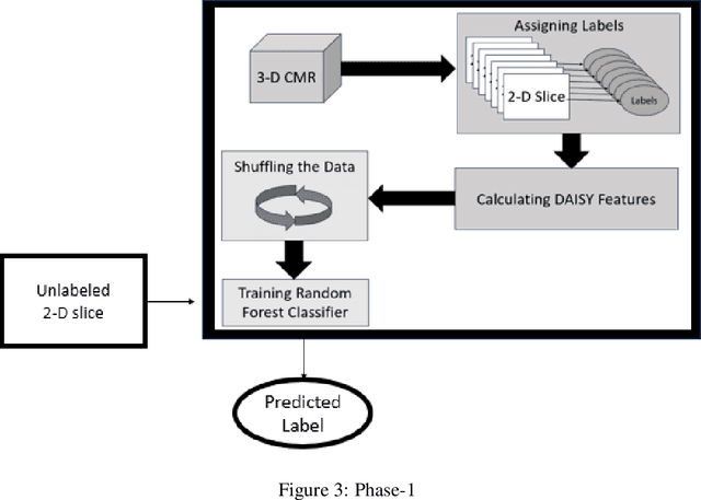 Figure 4 for Two-Phase Segmentation Approach for Accurate Left Ventricle Segmentation in Cardiac MRI using Machine Learning