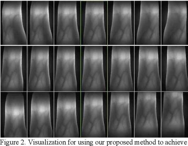Figure 3 for Motion Transfer-Driven intra-class data augmentation for Finger Vein Recognition