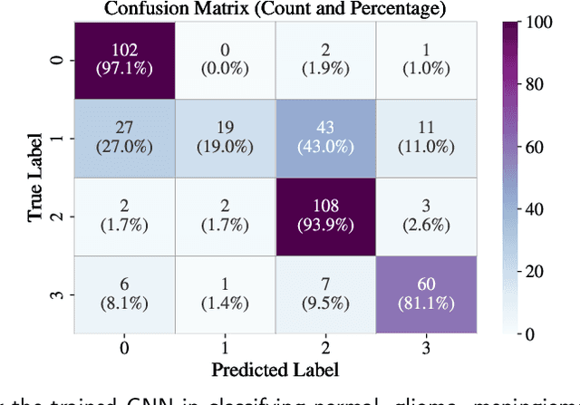 Figure 3 for Machine Learning Approach to Brain Tumor Detection and Classification