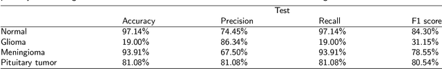 Figure 4 for Machine Learning Approach to Brain Tumor Detection and Classification