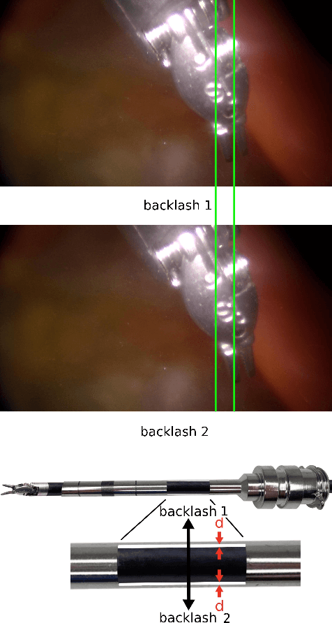 Figure 2 for Caveats on the first-generation da Vinci Research Kit: latent technical constraints and essential calibrations