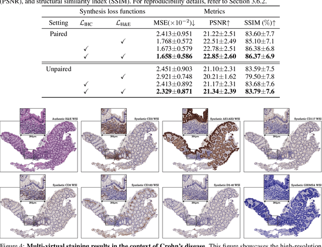 Figure 4 for Scalable, Trustworthy Generative Model for Virtual Multi-Staining from H&E Whole Slide Images