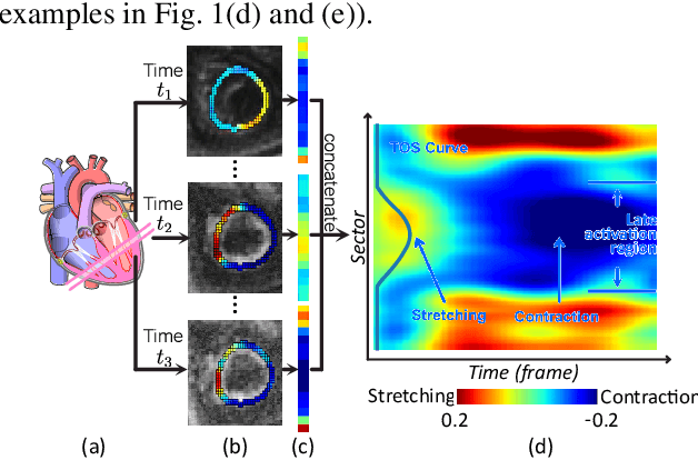 Figure 1 for Multitask Learning for Improved Late Mechanical Activation Detection of Heart from Cine DENSE MRI