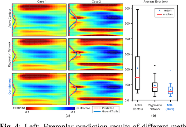 Figure 4 for Multitask Learning for Improved Late Mechanical Activation Detection of Heart from Cine DENSE MRI