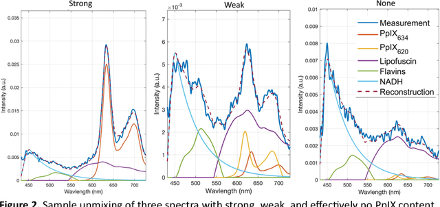 Figure 3 for Deep Learning-Based Correction and Unmixing of Hyperspectral Images for Brain Tumor Surgery